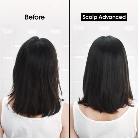 Shampoing Scalp Advanced "Anti-Gras" 300ML
