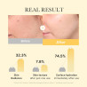 Masque Gel Kojic Acid "Turmeric Brightening Gel Mask" 1 unité
